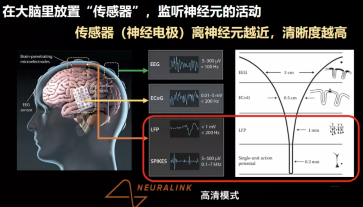 脑控芯片注射图片