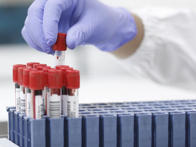 罗氏诊断全新发布，为实验室标准化带来革新突破